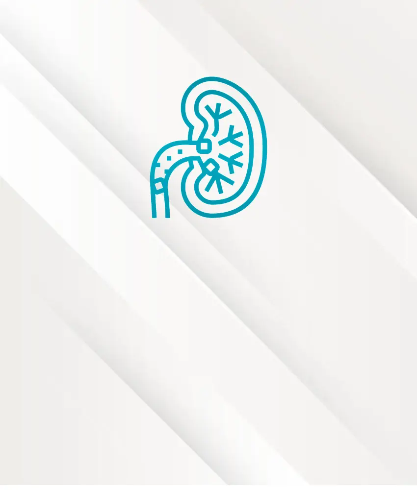 litiasis urinaria urológo dr edgar beltrán suárez